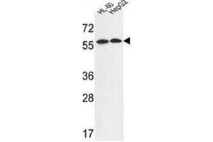 Western blot analysis of FANCC Antibody (C-term) in HL-60,HepG2 cell line lysates (35ug/lane). (FANCC Antikörper  (C-Term))