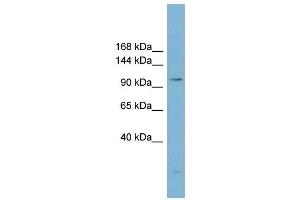 WB Suggested Anti-ACLY  Antibody Titration: 0. (ACLY Antikörper  (Middle Region))