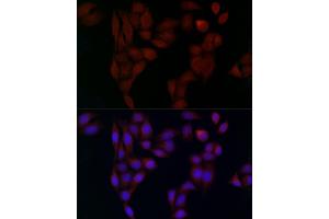 Immunofluorescence (IF) image for anti-Adaptor-Related Protein Complex 2, alpha 2 Subunit (AP2A2) (AA 590-939) antibody (ABIN6136955)