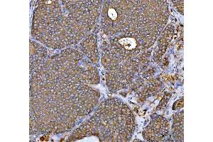 IHC analysis of MRPS22 using anti-MRPS22 antibody (ABIN7600613). (MRPS22 Antikörper  (AA 21-329))