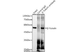Immunoprecipitation analysis of 300 μg extracts of 293T cells using 3 μg β-Tubulin antibody (ABIN7271043). (TUBB Antikörper)