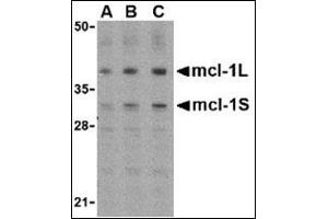 Western blot analysis of Mcl-1 in Raji cell lysates with AP30549PU-N (IN) at (A) 0. (MCL-1 Antikörper  (Center))