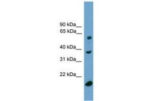 TBL1Y antibody  (C-Term)