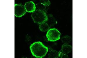 Immunofluorescence (IF) image for anti-HHV6 gQ1 (AA 3-422) antibody (ABIN2452012) (HHV6 gQ1 (AA 3-422) Antikörper)