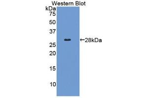 Detection of Recombinant COL4a2, Human using Polyclonal Antibody to Collagen Type IV Alpha 2 (COL4a2) (COL4a2 Antikörper  (AA 1487-1703))