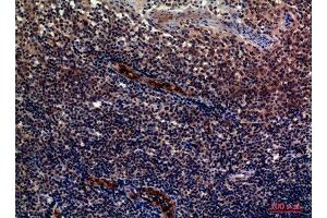 Immunohistochemistry (IHC) analysis of paraffin-embedded Human Tonsils, antibody was diluted at 1:100.