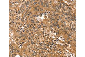 Immunohistochemistry (IHC) image for anti-Synovial Sarcoma, X Breakpoint 2 Interacting Protein (SSX2IP) antibody (ABIN2430871) (SSX2IP Antikörper)