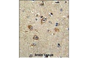 Immunohistochemistry (Paraffin-embedded Sections) (IHC (p)) image for anti-PTK2 Protein tyrosine Kinase 2 (PTK2) (AA 396-423) antibody (ABIN1882121)