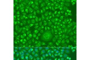 Immunofluorescence analysis of U2OS cells using IFNW1 Polyclonal Antibody at dilution of 1:100. (IFNW1 Antikörper)