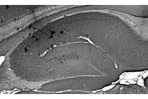 Adult rat hippocampus immunohistochemistry. (GIT1 Antikörper  (C-Term))