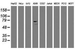 Image no. 5 for anti-Coagulation Factor XIII, A1 Polypeptide (F13A1) antibody (ABIN1498151) (F13A1 Antikörper)