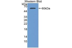 Western blot analysis of the recombinant protein. (AGGF1 Antikörper  (AA 263-507))