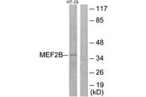 Western blot analysis of extracts from HT-29 cells, using MEF2B Antibody. (MEF2B Antikörper  (AA 51-100))
