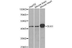 Western blot analysis of extracts of various cell lines, using DLK1 antibody. (DLK1 Antikörper  (AA 83-383))
