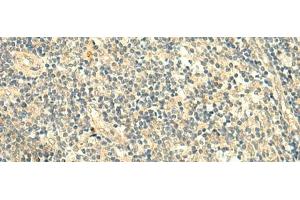 Immunohistochemistry of paraffin-embedded Human tonsil tissue using TMEM9 Polyclonal Antibody at dilution of 1:50(x200) (TMEM9 Antikörper)