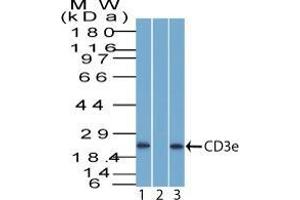 Western Blotting (WB) image for anti-CD3 epsilon (CD3E) (AA 156-168) antibody (ABIN6941037)