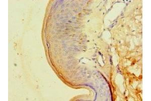 Immunohistochemistry of paraffin-embedded human skin tissue using ABIN7146714 at dilution of 1:100 (CA14 Antikörper  (AA 16-290))