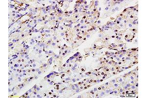 Formalin-fixed and paraffin embedded rat pancreas labeled with Anti-ASF1A Polyclonal Antibody, Unconjugated (ABIN703961) at 1:200 followed by conjugation to the secondary antibody and DAB staining (ASF1A Antikörper  (AA 101-204))
