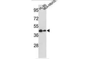 Western blot analysis of GSDMB Antibody (Center) in HL-60, MDA-MB435 cell line lysates (35ug/lane). (Gasdermin B Antikörper  (Middle Region))