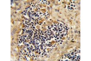 Immunohistochemistry (IHC) image for anti-Receptor Tyrosine Kinase-Like Orphan Receptor 2 (ROR2) (AA 19-50) antibody (ABIN3032442)