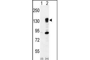 Western blot analysis of ITGA5 (arrow) using rabbit polyclonal ITGA5 Antibody (Center) (ABIN656138 and ABIN2845477). (ITGA5 Antikörper  (AA 575-602))