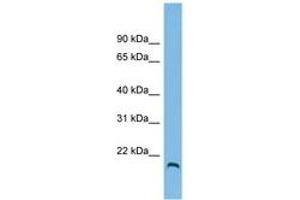 Image no. 1 for anti-Hemochromatosis Type 2 (Juvenile) (HFE2) (AA 35-84) antibody (ABIN6745034)