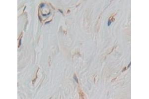 IHC-P analysis of Human Tissue, with DAB staining. (TLR5 Antikörper  (AA 303-514))