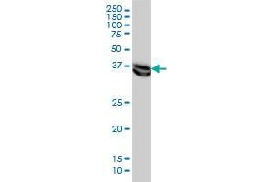 MAPK3 monoclonal antibody (M02), clone 1B1 Western Blot analysis of MAPK3 expression in HeLa .