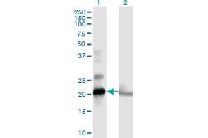 Western Blot analysis of COMMD1 expression in transfected 293T cell line by COMMD1 MaxPab polyclonal antibody. (COMMD1 Antikörper  (AA 1-190))
