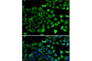Immunofluorescence analysis of A-549 cells using NFYB Polyclonal Antibody (NFYB Antikörper)