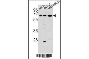 Western blot analysis in Jurkat,ZR-75-1,MDA-MB231 cell line lysates (35ug/lane). (ZSCAN2 Antikörper  (N-Term))