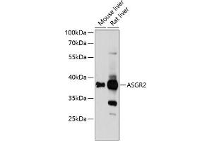 Western blot analysis of extracts of various cell lines, using  Antibody (ABIN6127455, ABIN6137182, ABIN6137185 and ABIN6218131) at 1:1000 dilution. (Asialoglycoprotein Receptor 2 Antikörper  (AA 131-287))