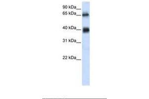 Image no. 1 for anti-Zinc Finger with UFM1-Specific Peptidase Domain (ZUFSP) (AA 254-303) antibody (ABIN6739108) (ZUFSP Antikörper  (AA 254-303))