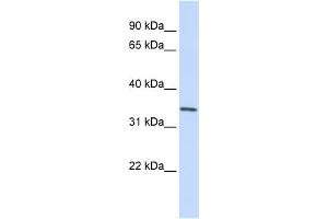 WB Suggested Anti-GNPDA1 Antibody Titration:  0. (GNPDA1 Antikörper  (C-Term))