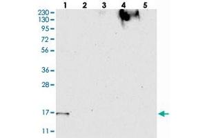 Western blot analysis of Lane 1: RT-4, Lane 2: U-251 MG, Lane 3: Human Plasma, Lane 4: Liver, Lane 5: Tonsil with FAM162A polyclonal antibody  at 1:250-1:500 dilution.