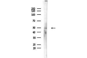 anti-Plasmalemma Vesicle Associated Protein (PLVAP) (C-Term) antibody