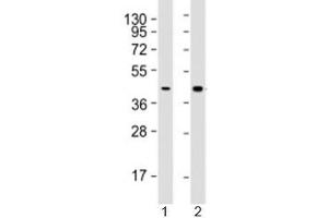 Western blot testing of human 1) HepG2 (liver carcinoma line) and 2) liver lysate with AGXT antibody at 1:2000. (AGXT Antikörper  (AA 188-375))
