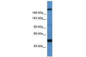 WB Suggested Anti-TCF20 Antibody Titration:  0. (TCF20 Antikörper  (C-Term))