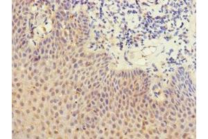 Immunohistochemistry of paraffin-embedded human tonsil tissue using ABIN7158638 at dilution of 1:100 (LY75/DEC-205 Antikörper  (AA 440-680))