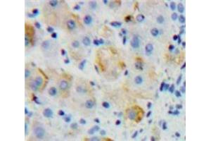 Immunohistochemistry (IHC) image for anti-Fc Fragment of IgG, High Affinity Ia, Receptor (CD64) (FCGR1A) (AA 35-235) antibody (ABIN7433813)