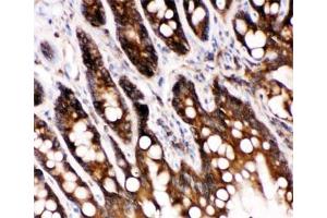 IHC-P: Caspase-6 antibody testing of rat intestine tissue (Caspase 6 Antikörper  (AA 7-27))