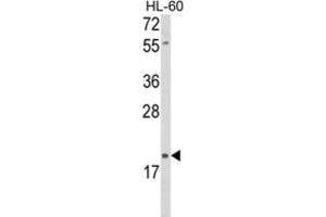 Western Blotting (WB) image for anti-delta-Like 2 Homolog (DLK2) antibody (ABIN5024466) (DLK2 Antikörper)