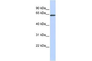 WB Suggested Anti-ANTXR1 Antibody Titration:  0. (ANTXR1 Antikörper  (Middle Region))