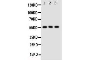 Western Blotting (WB) image for anti-Solute Carrier Family 2 (Facilitated Glucose/fructose Transporter), Member 5 (SLC2A5) (AA 232-251), (Middle Region) antibody (ABIN3044131) (SLC2A5 Antikörper  (Middle Region))
