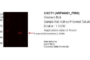Western Blotting (WB) image for anti-3-Oxoacid CoA Transferase 1 (OXCT1) (Middle Region) antibody (ABIN2783388)