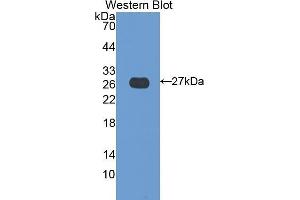 Western Blotting (WB) image for anti-Transglutaminase 3 (E Polypeptide, Protein-Glutamine-gamma-Glutamyltransferase) (TGM3) (AA 468-693) antibody (ABIN1078610)