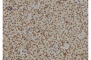 ABIN6269101 at 1/100 staining Rat kidney tissue by IHC-P. (Retinoblastoma 1 Antikörper  (C-Term))