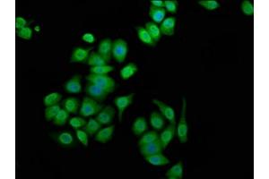 Immunofluorescence staining of PC-3 cells with ABIN7144251 at 1:100, counter-stained with DAPI. (Ankyrin G Antikörper  (AA 3540-3719))