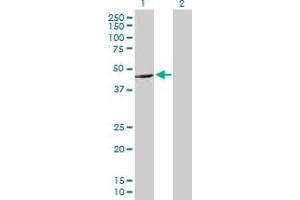 Western Blot analysis of C16orf70 expression in transfected 293T cell line by C16orf70 MaxPab polyclonal antibody. (C16orf70 Antikörper  (AA 1-422))