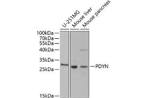 Western blot analysis of extracts of various cell lines, using PDYN antibody (ABIN6129606, ABIN6145418, ABIN6145419 and ABIN6221524) at 1:1000 dilution. (PDYN Antikörper  (AA 21-254))